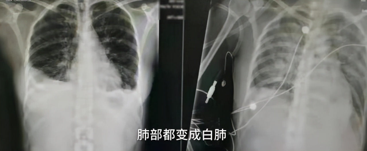 撸猫惹上虫子的早期症状,撸猫需谨慎担心猫抓病