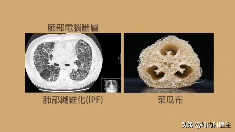 钟南山院士谈如何对待疾病,钟南山院士推荐十大治疗方法