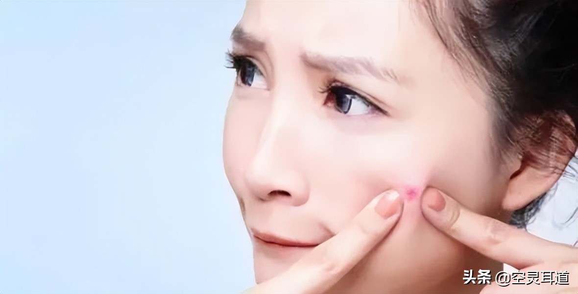 祛痘最佳攻略,祛痘治痘全过程