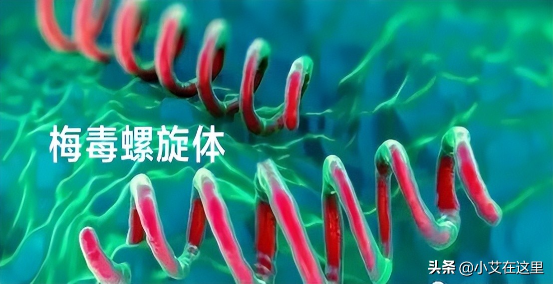 梅毒和艾滋病哪个更可怕,梅毒与艾滋病谁更可怕