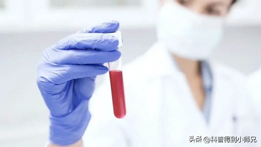 熊猫血恐龙血，人类有35种血型系统！除了ABO，你还知道哪一种？