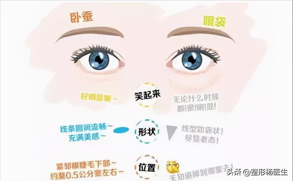 眼袋手术后真的显年轻吗,割眼袋能年轻几岁