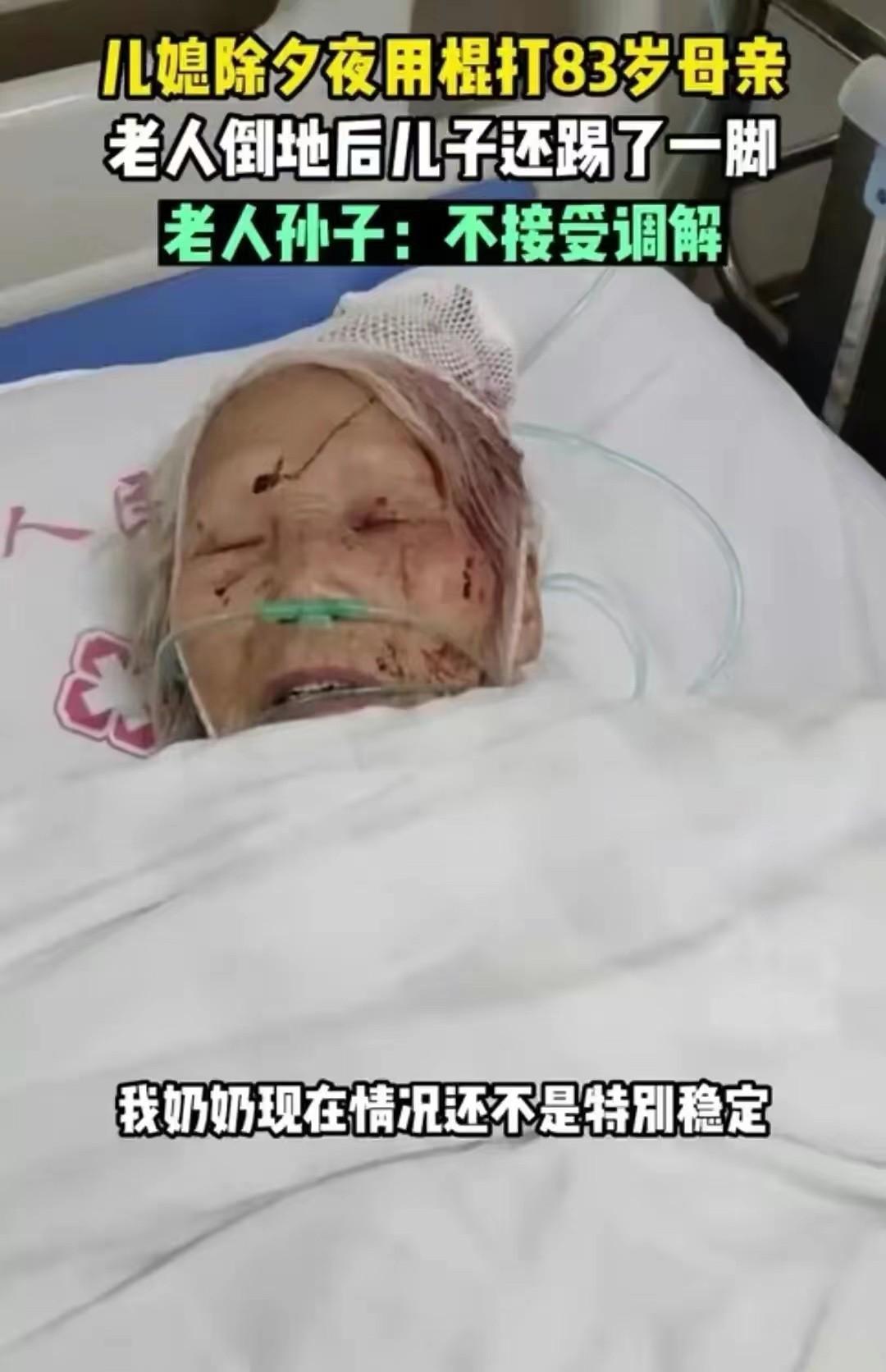 除夕夜儿媳殴打83岁婆婆，倒地后被丈夫一脚踢开，目前未脱离危险