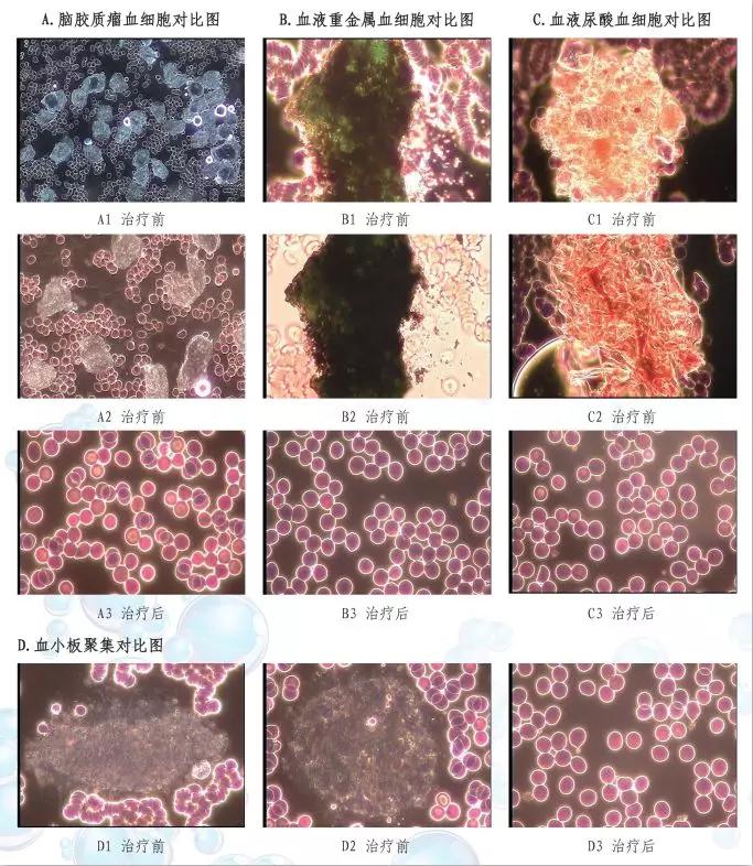 臭氧脑梗,烟酒都戒了还有什么戒不了