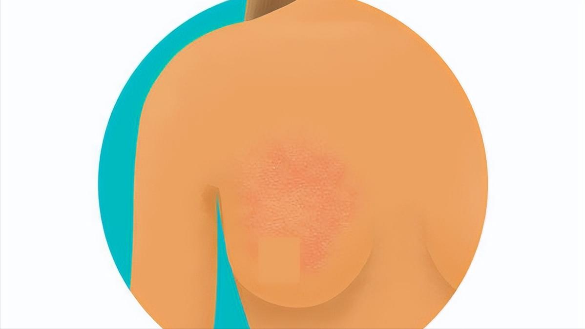 女性熬夜的危害会引发5大妇科病,经常熬夜对女性身体的危害有哪些