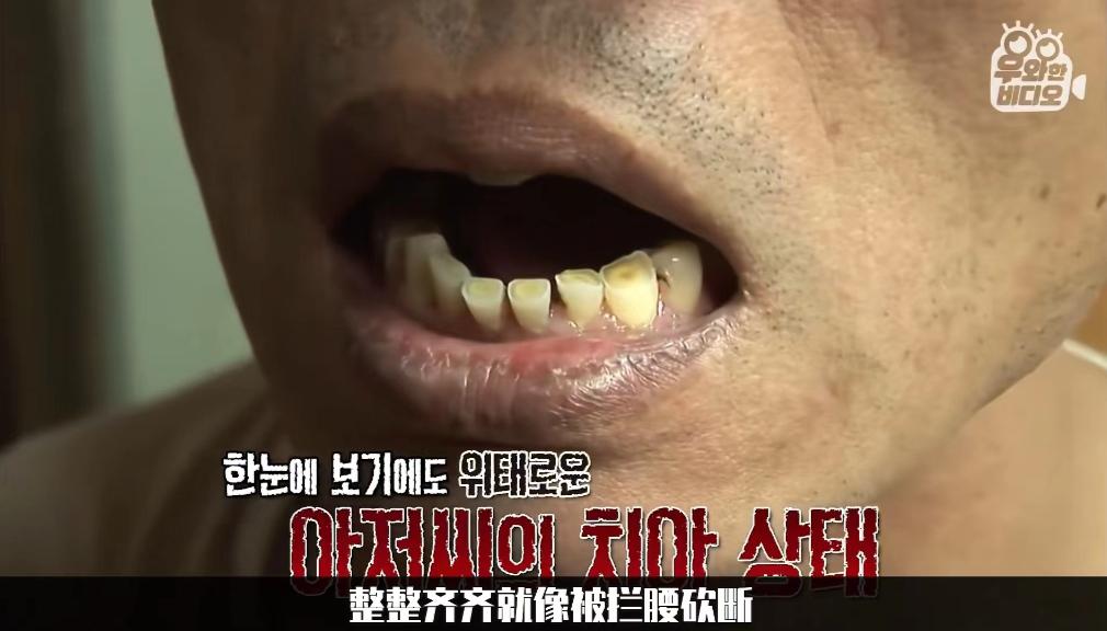 睡觉每晚都磨牙到底是什么原因,夜里睡觉一直磨牙是什么原因