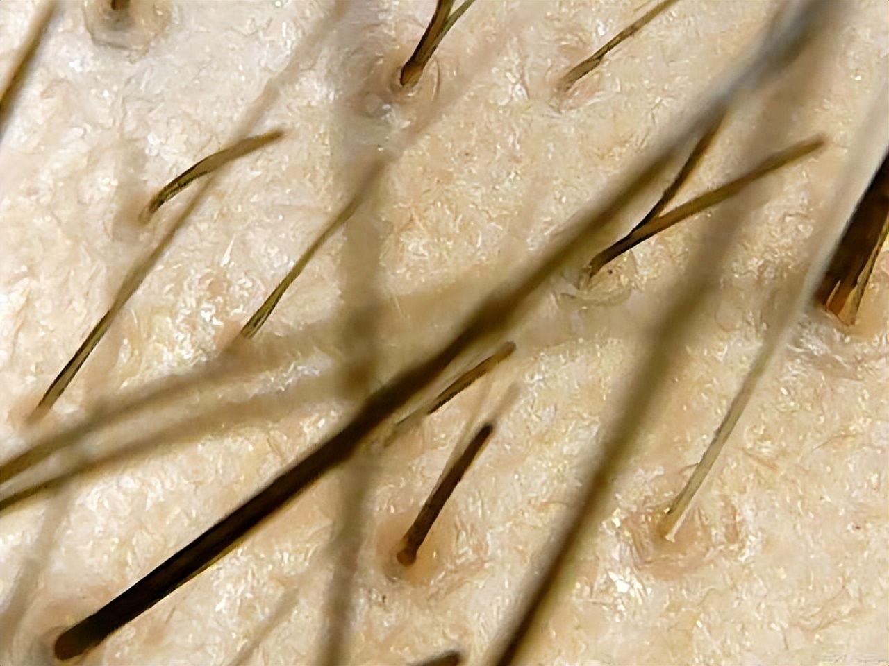 女性毛发越来越重是什么原因,女人毛发脱落严重