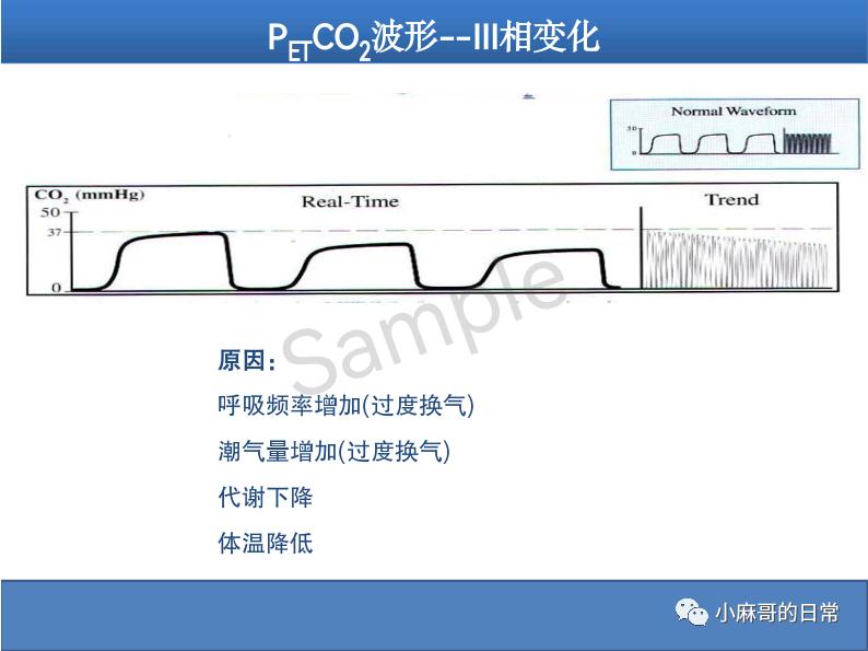 呼气末二氧化碳检测图的解读,呼气末二氧化碳检测操作视频