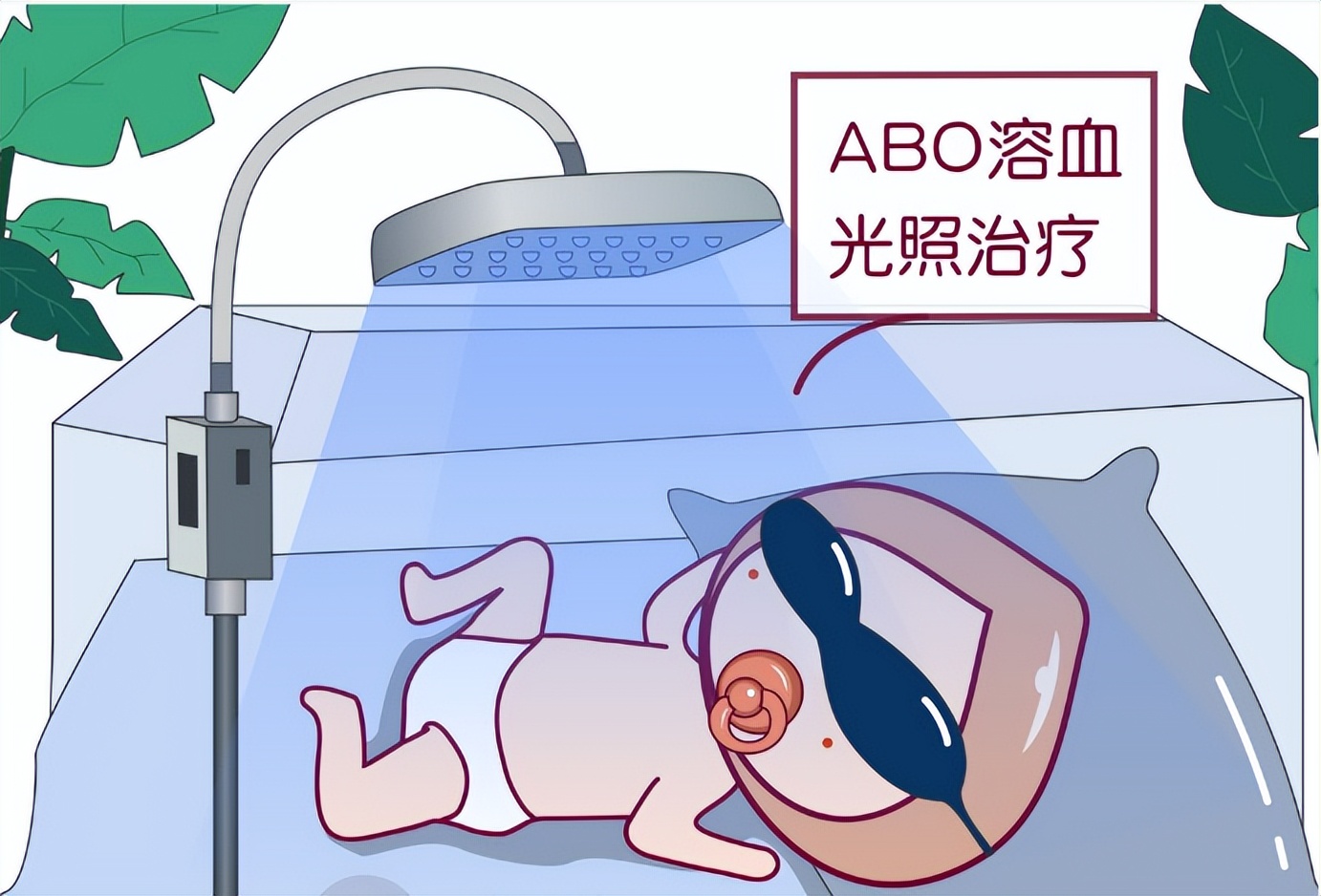 母婴血型不合黄疸高怎么办,母婴血型不合的胎儿贫血怎么办