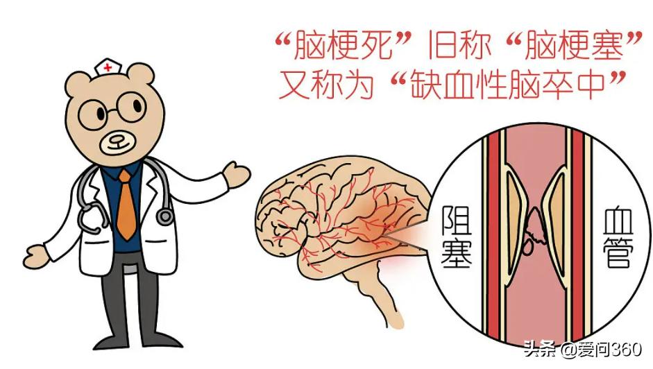 脑梗来之前，这几种症状很明显，碰到就不要掉以轻心了