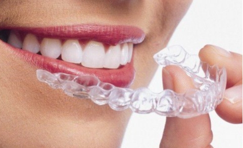 美恒牙齿矫正怎么样,美牙科普小知识