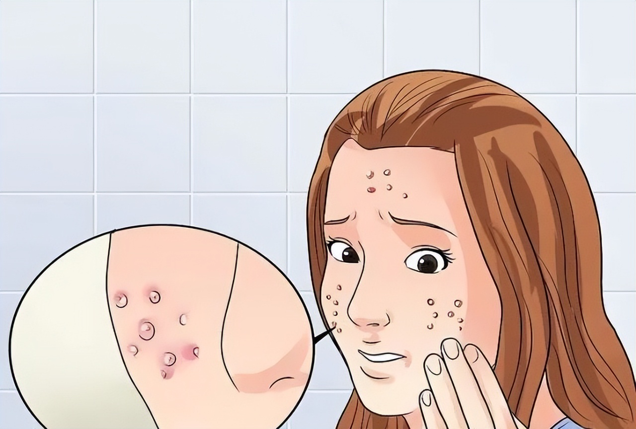 突然长很多痘痘中医如何调理,长期长痘痘怎么中医调理