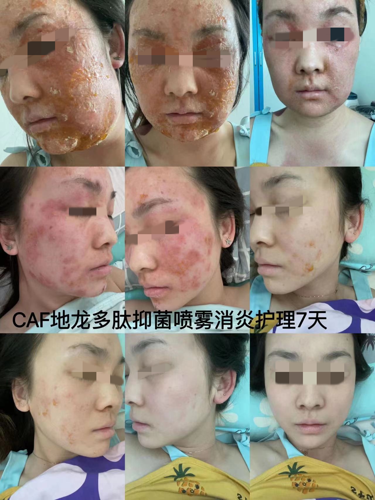 地龙多肽抑菌特护,地龙多肽抑菌喷雾在哪能买到