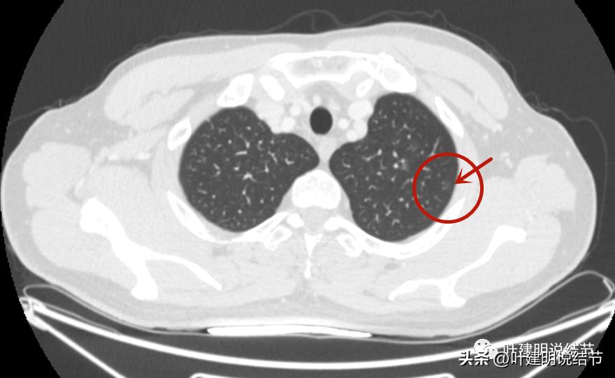 医生为了预防医患矛盾过度诊疗,医院过度医疗手术