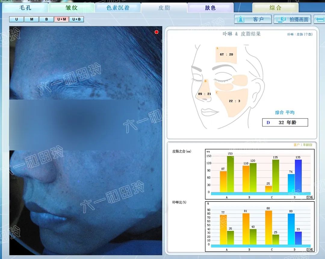 各种酸的用途及使用方法,各种酸的种类及不同的功效
