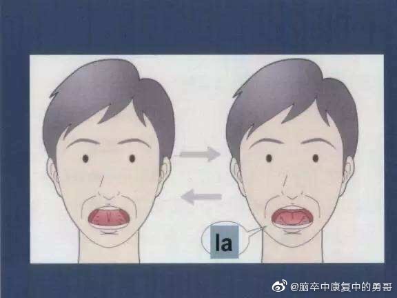 语言障碍康复评估训练系统,语言障碍康复训练20岁