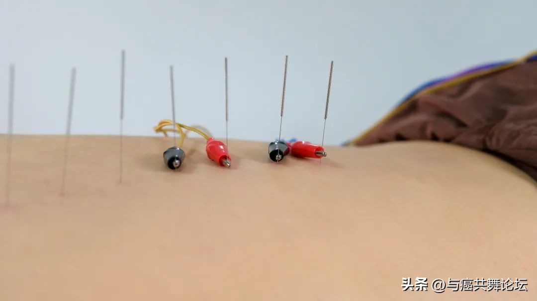 镇痛药便秘,用止痛药便秘有什么办法