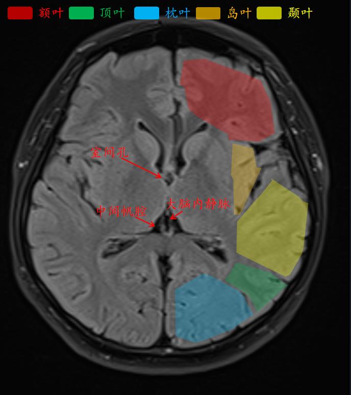 肘关节mri图谱大全,腕关节mri解剖图谱