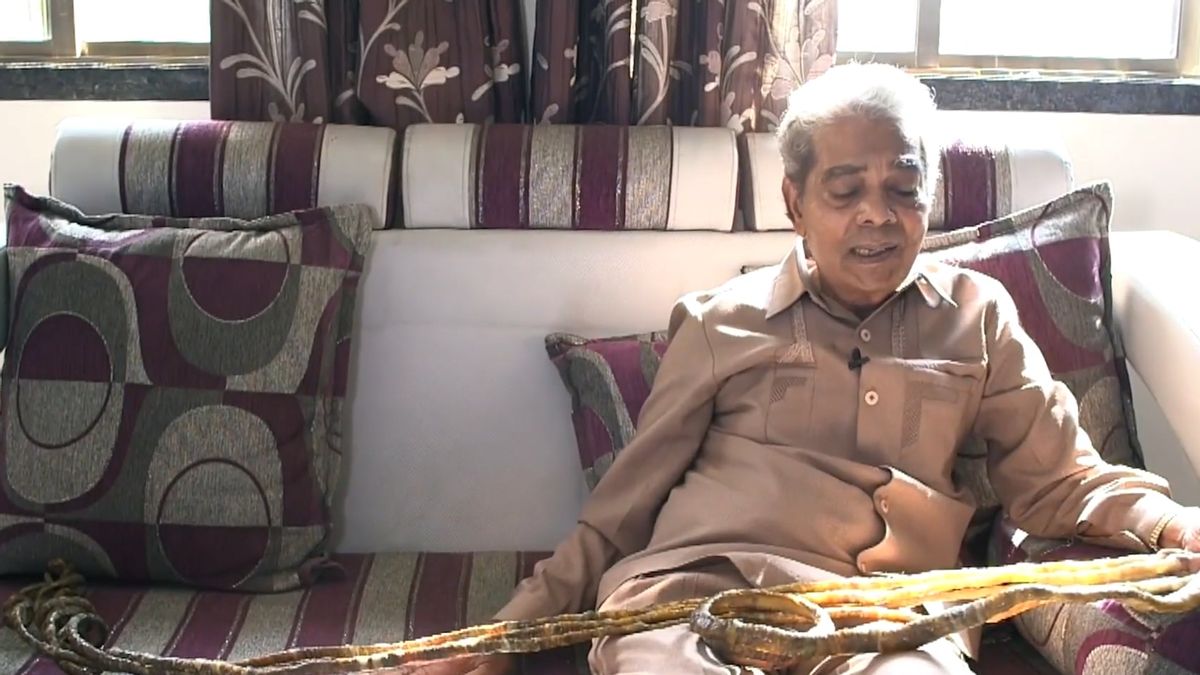 世界上身体部位最奇特的五个人,世界上身体最长的一个部位