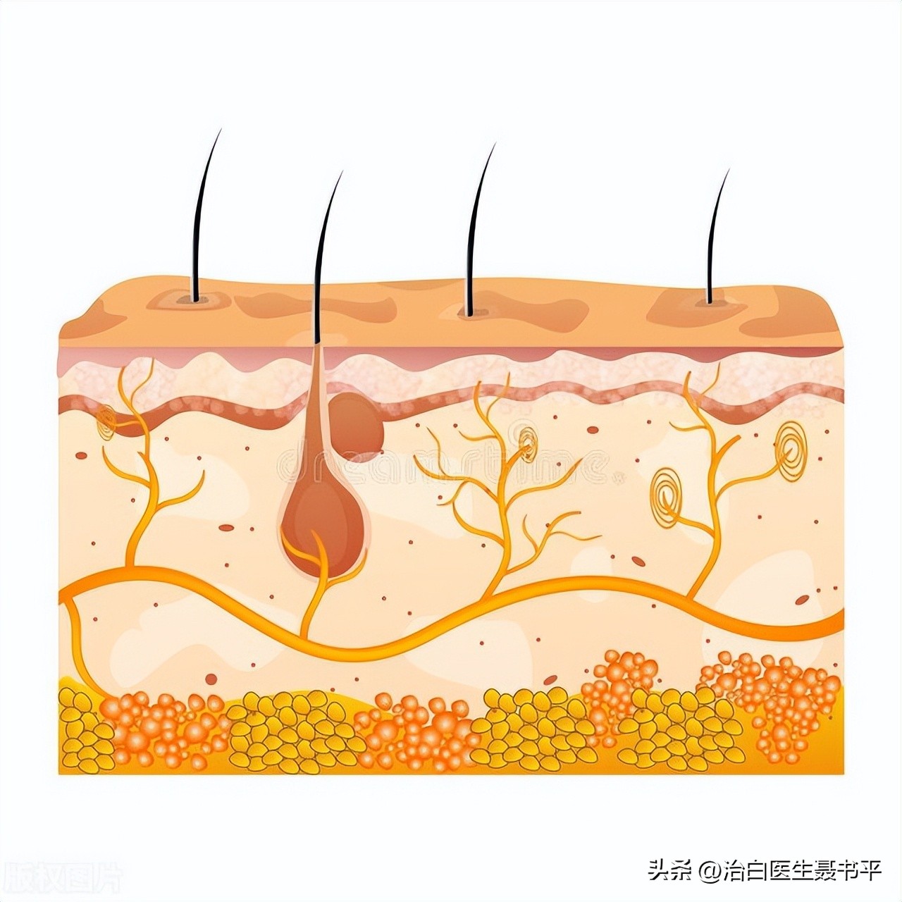 点阵激光疗法，打破白癜风治疗瓶颈