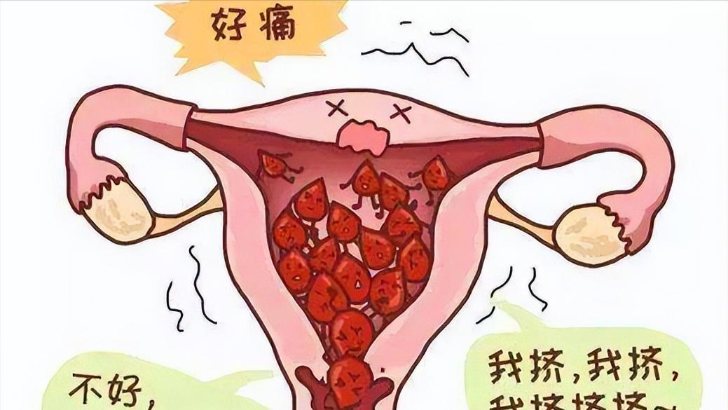 女子头晕胸闷,以为心肺不好,医生看到她的指甲怀疑子宫肌瘤