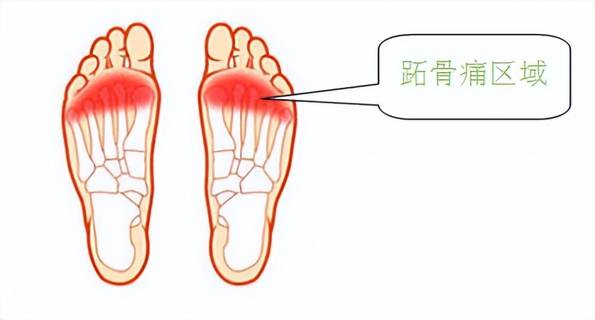 走路时前脚掌疼是怎么回事,走路时左脚后跟疼警惕四种原因