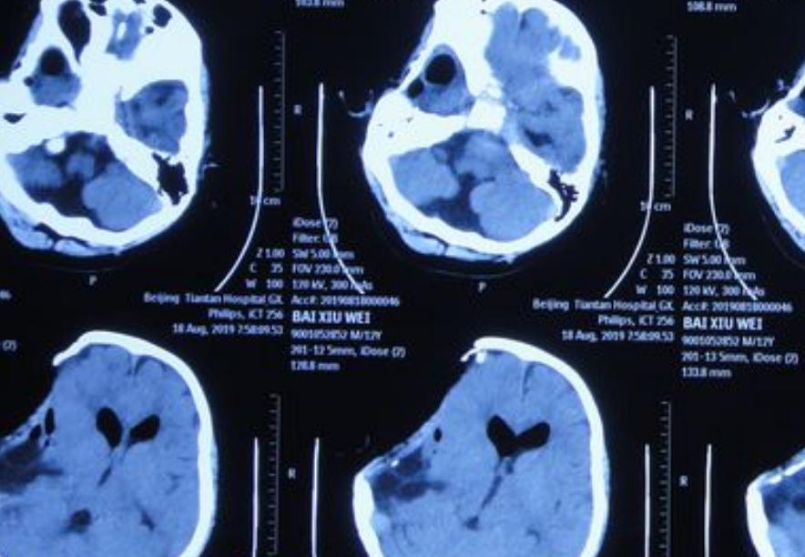 耳朵总是痒痒是身体哪里出问题了,耳朵经常痒得很是什么原因