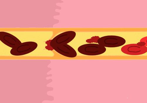 经期前综合症逍遥丸,经前期综合征吃什么逍遥丸