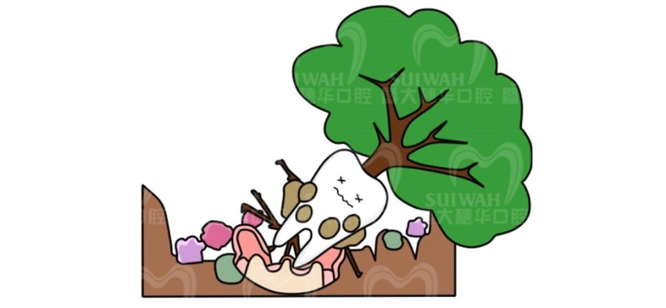 根管治疗后不戴牙套后坏掉了,根管治疗后不戴牙冠的后果