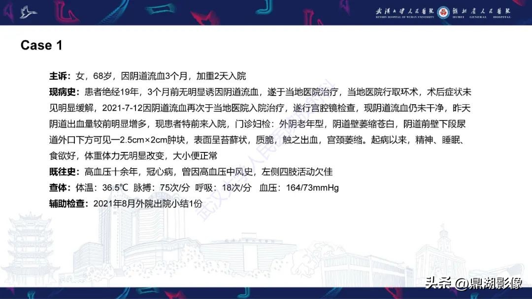 阴道肉瘤的早期症状,阴道里长肉瘤是啥症状