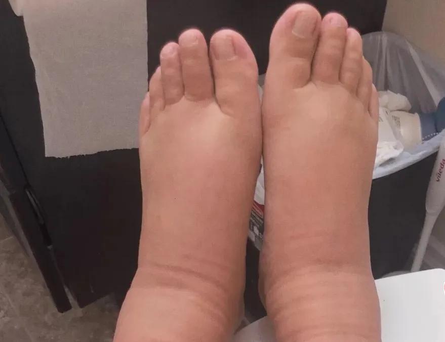 怀孕后脚大一码还能恢复吗,怀孕后脚变大怎么恢复