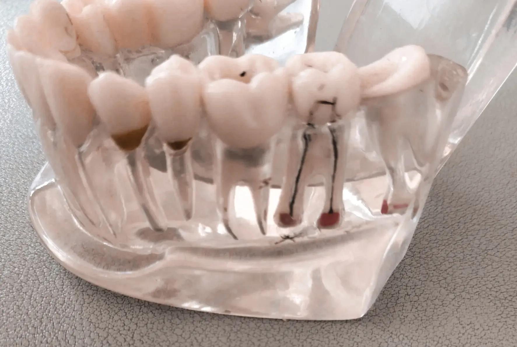 隔离期间如何熬过牙疼,隔离在家牙疼怎么办