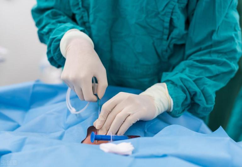 心脏支架手术一般能活多少年,做了心脏支架正常情况能活多少年