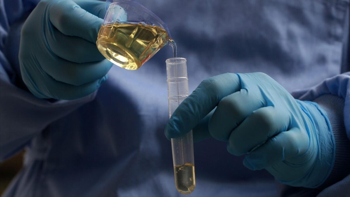 胆囊肿瘤的前兆,胆囊发生前期病变