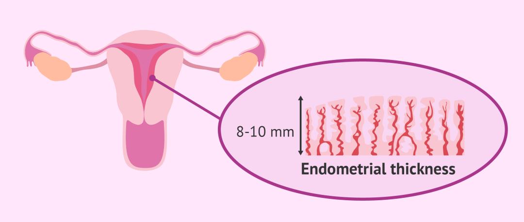 子宫内膜与妊娠,子宫内膜避孕器取出手术需要多久