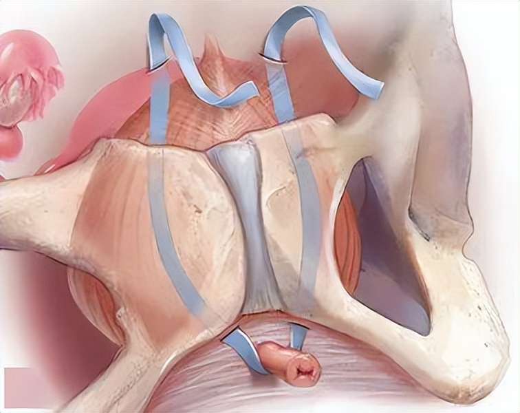 关爱女性关注盆底健康,市人民医院关爱女性健康