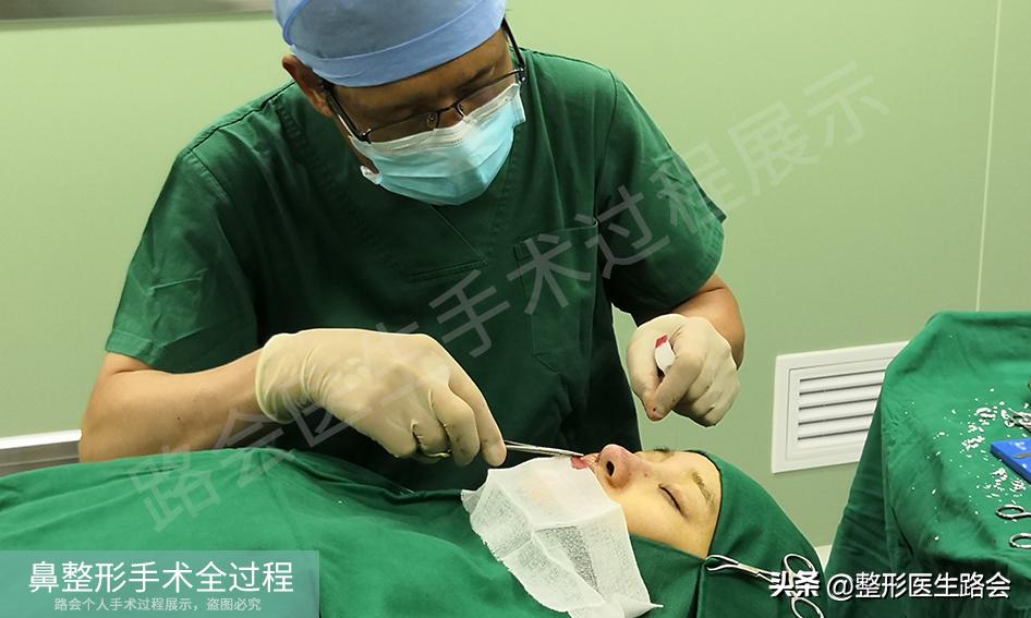 隆鼻手术全过程女生,隆鼻手术到底是怎么进行的