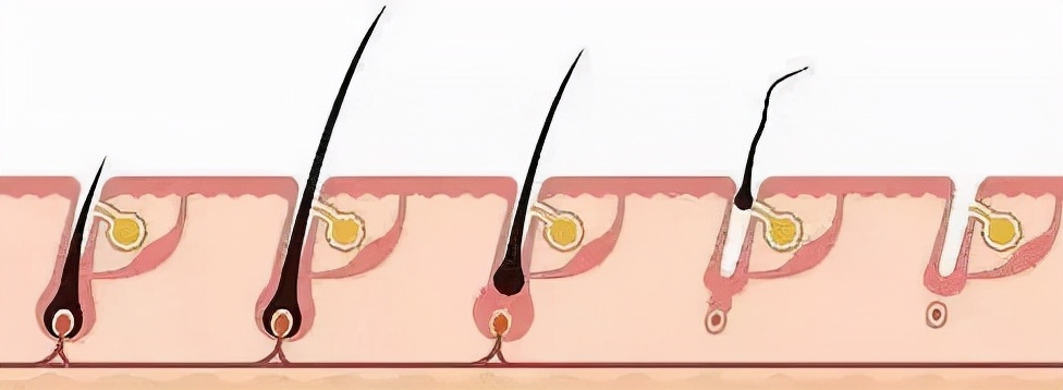 别人脱单你脱发,年轻人脱单脱发