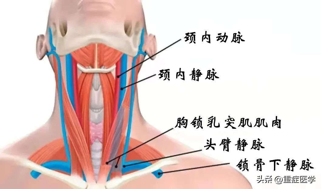 保姆级深静脉穿刺全攻略，建议收藏！