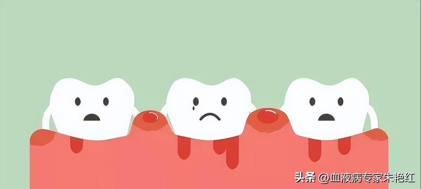 血小板减少症和mds的区别,mds血小板低是继发性还是原发性