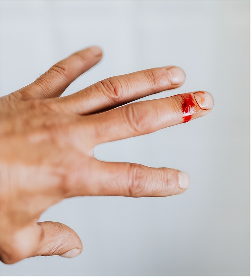 创口贴有用还是创可贴有用,创可贴和创口贴哪个能消毒