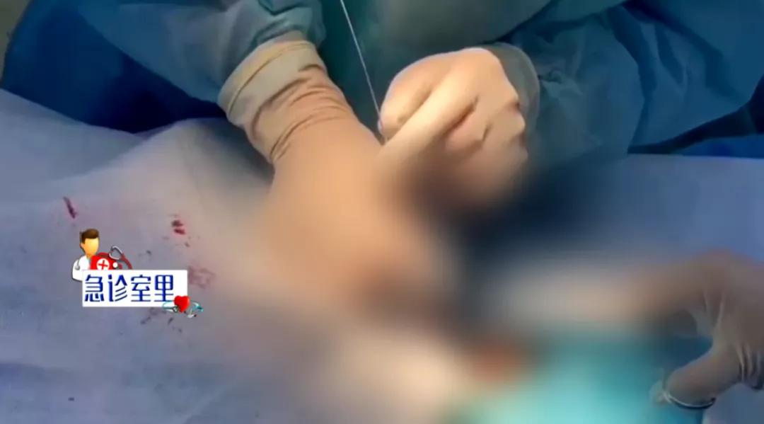 新生儿急性肾衰竭能治愈么,新生儿急性肾衰竭治好的几率