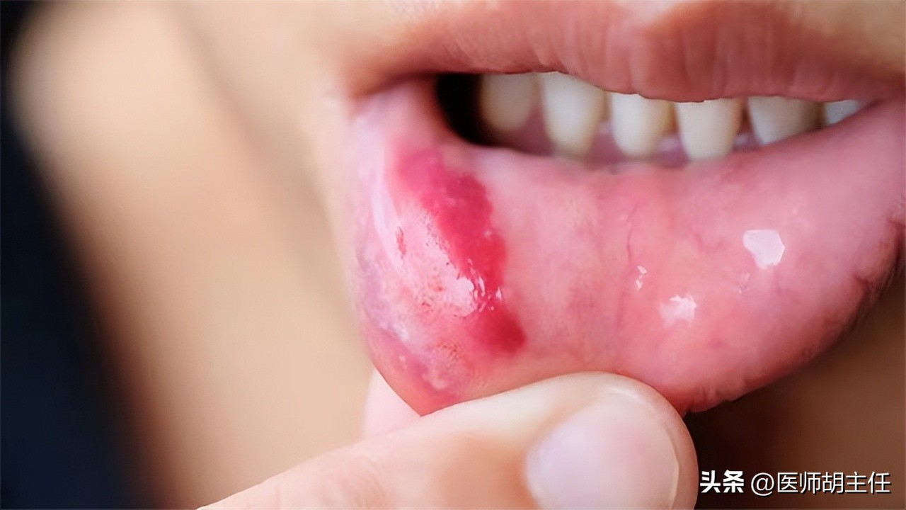 维生素b12一瓶的含量有多少,维生素b12主治哪些病症