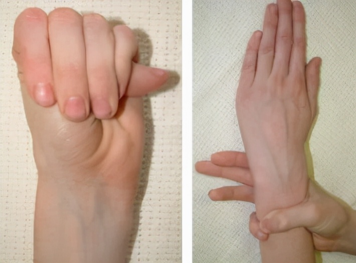 半片75mg厄贝沙坦的降压效果,75毫克厄贝沙坦一片能降多少血压