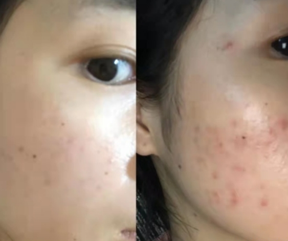 孕妇孕期护肤误区大揭秘,孕妇用的护肤品哪个最坑