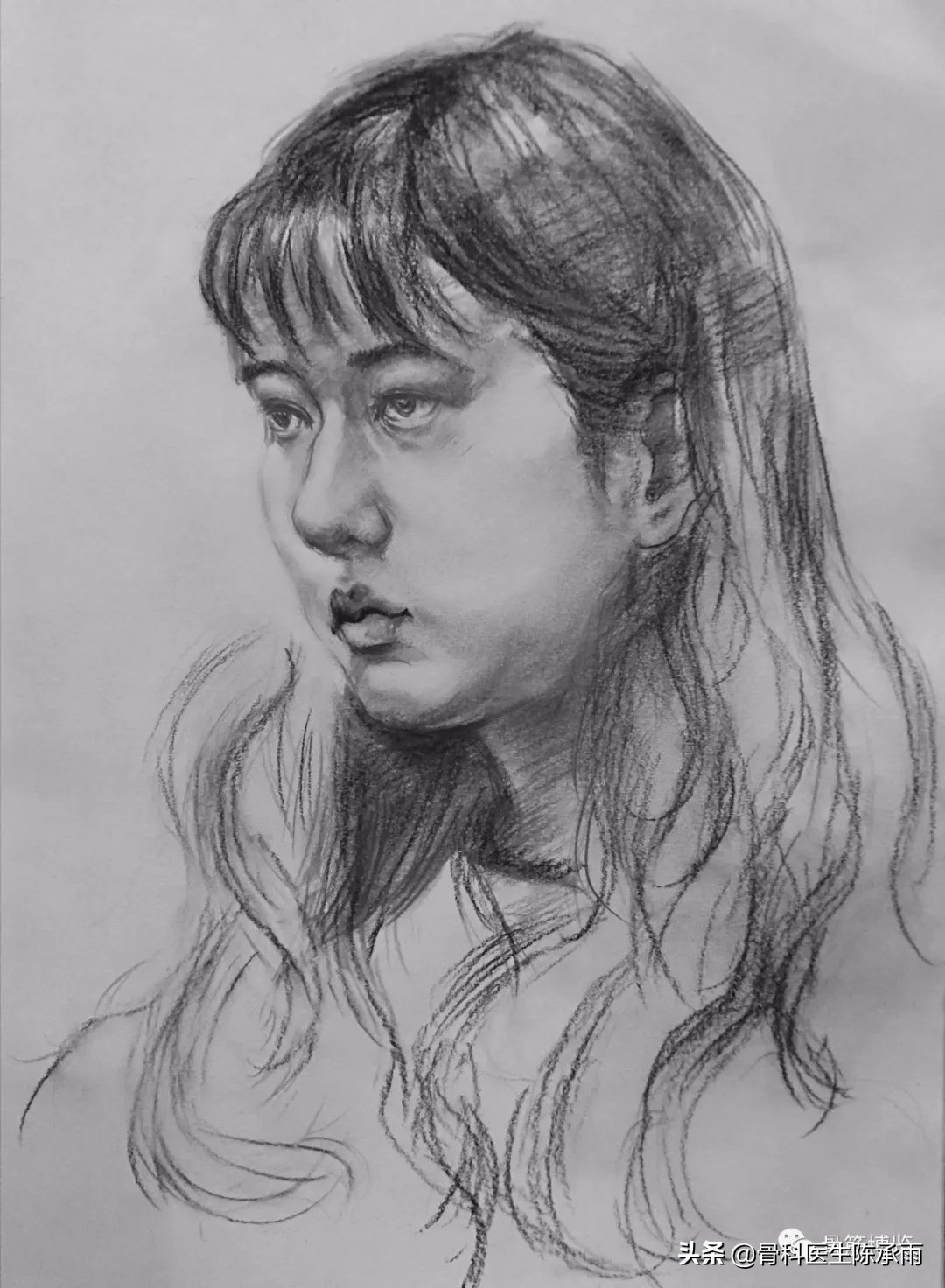 陈旧性腿骨骨折,陈旧性骨折