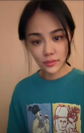 整容失败的女星蛇精脸,女星整容失败脸歪嘴斜