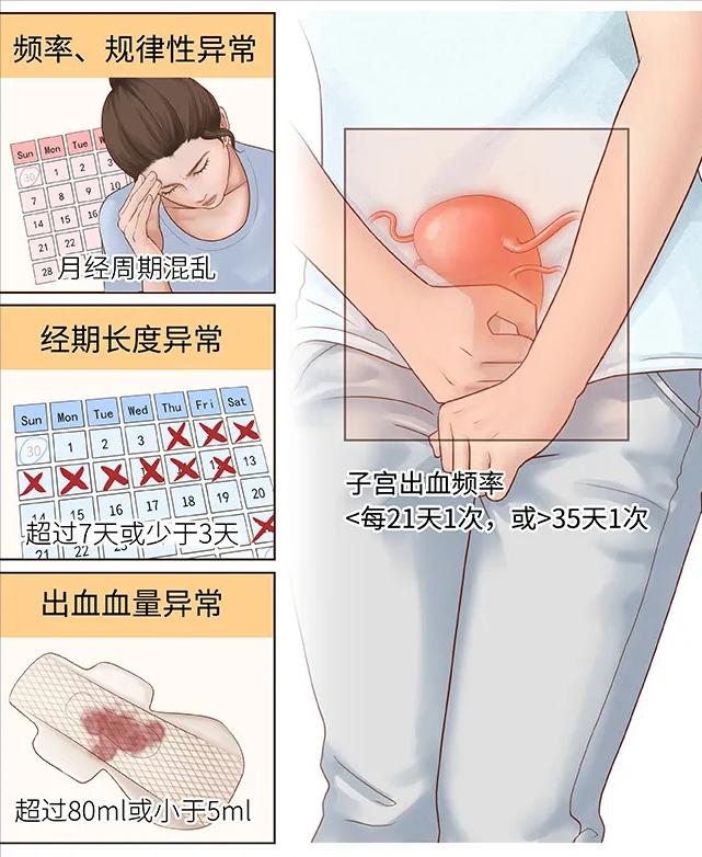 我月经不调,医生为什么给我开了避孕药?