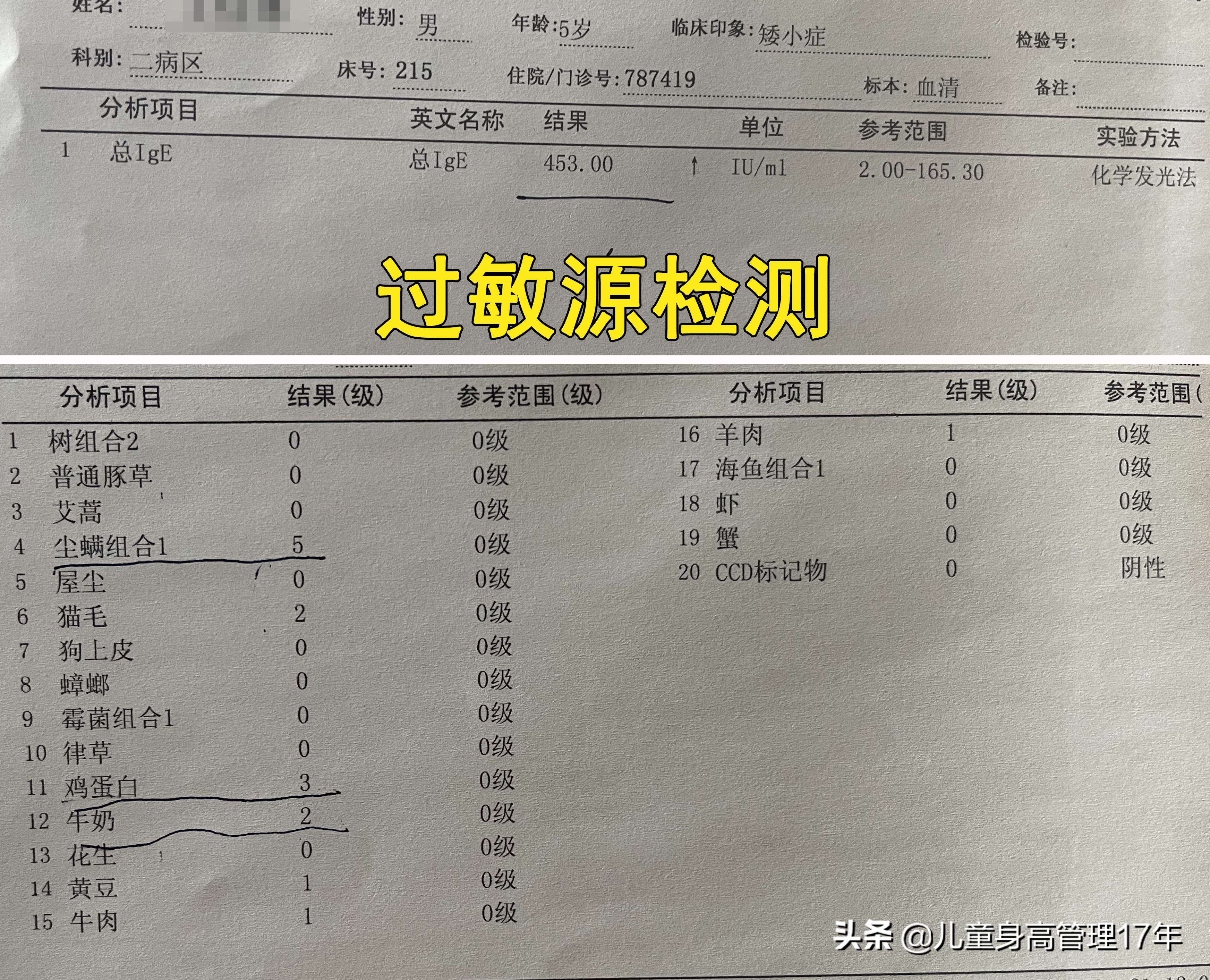 过敏体质的孩子过敏了怎么办,孩子过敏体质难长高