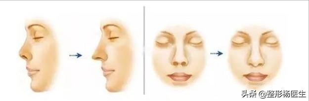 人中太长了好看吗,人中太长显老怎么办